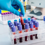 Thumbnail image for SEDI-ATI blood analysis application