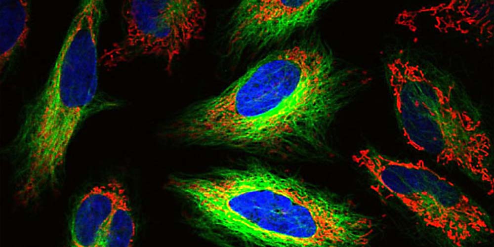 CASE-STUDY_Hyperspectral-imaging-with-wideband-optical-fibers